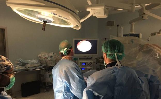 El Hospital de Poniente da un salto en el tratamiento de cálculos renales