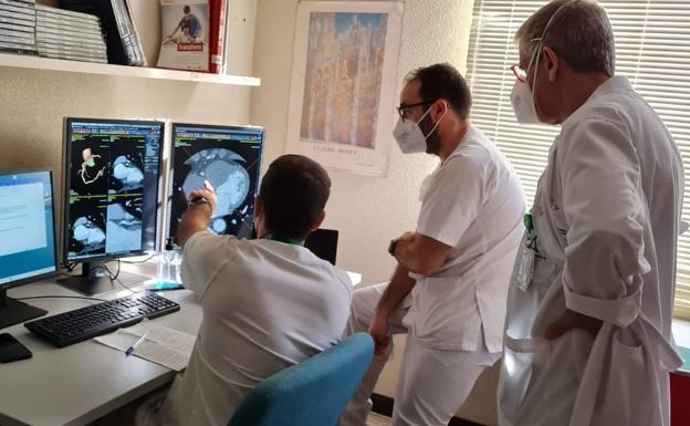 El Hospital de Poniente incorpora una técnica menos invasiva para detectar enfermedades del corazón