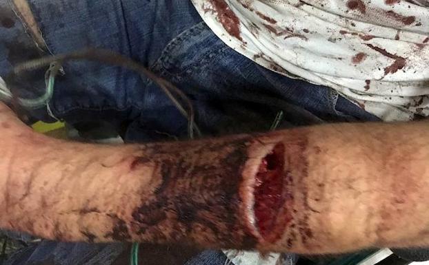 Fueron atacados por dos perros y estuvieron más de cinco horas en un olivo hasta que pudieron huir