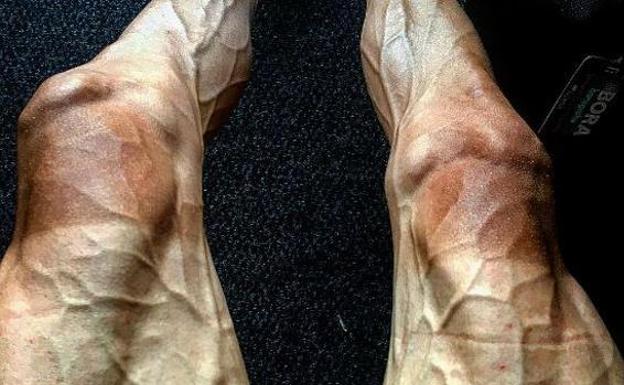 La impactante foto de las piernas de un ciclista en el Tour