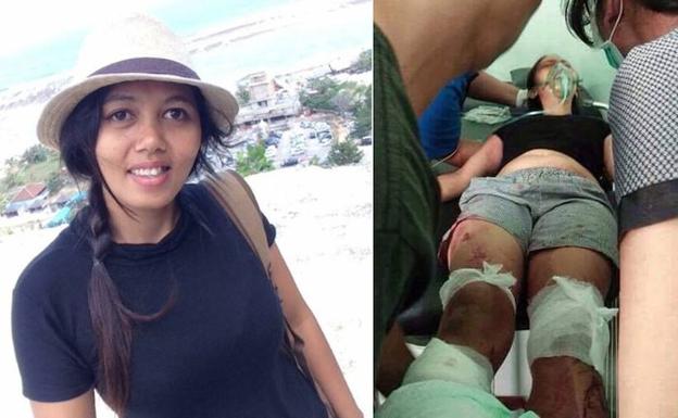 Su marido le amputa los dos pies al pensar que le había sido infiel