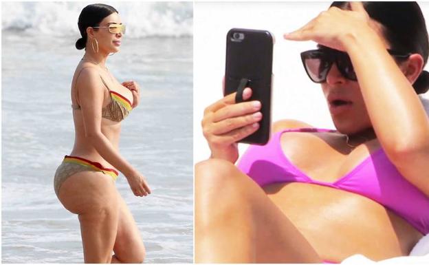 Kim Kardashian revela la extraña enfermedad que padece