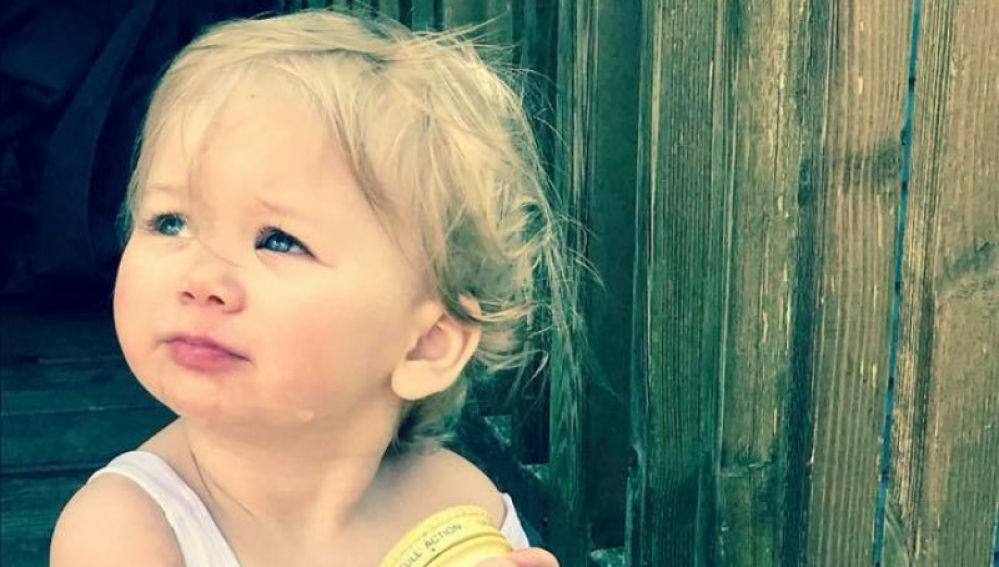 El rarísimo caso de la niña que tiene alergia al agua: cuando se baña le salen quemaduras