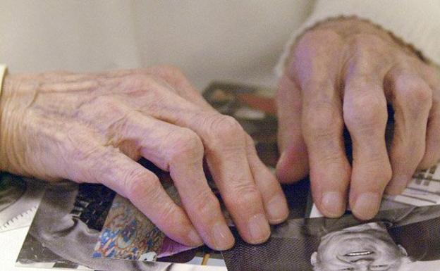 El virus del herpes podría tener relación con el alzhéimer