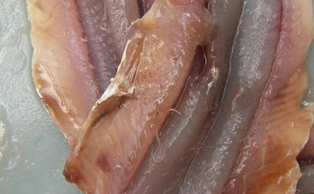 Anisakis: Primeros casos de intoxicación por anisakis en pescado