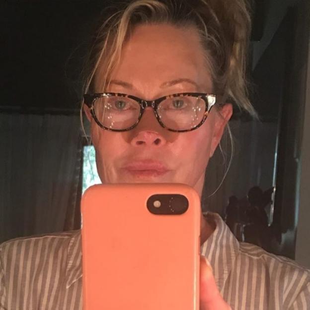 Melanie Griffith se opera un melanoma y lanza un importante aviso