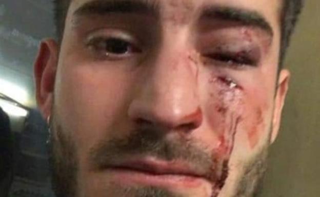 Detienen a los presuntos autores de la agresión homófoba a un joven de Huelma