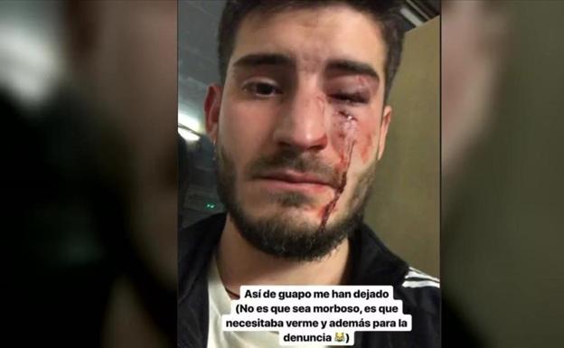 El Consejo General de Enfermería condena la «brutal agresión homófoba» al jienense Diego Martos