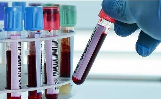 El análisis de sangre que podría predecir la probabilidad de muerte en 5 o 10 años