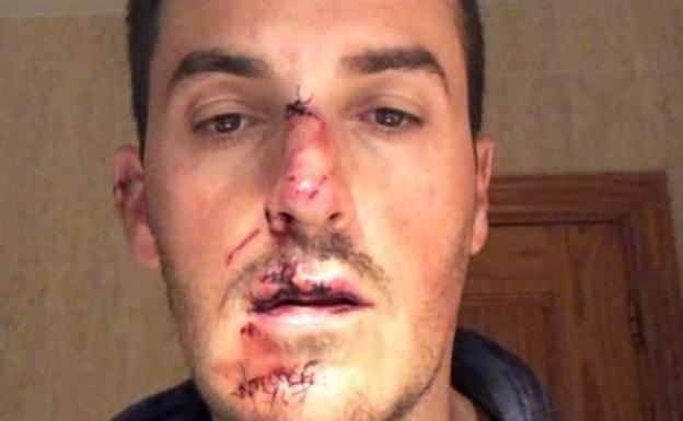 El propietario del coche que atropelló a un ciclista en Gójar no tiene carnet de conducir