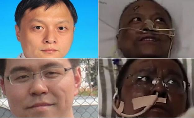 ¿Por qué dos médicos chinos se han vuelto negros tras superar la COVID-19?