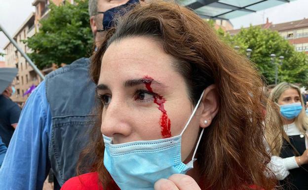 Hieren de una pedrada a la diputada Rocío de Meer en un mitin de Vox en Sestao