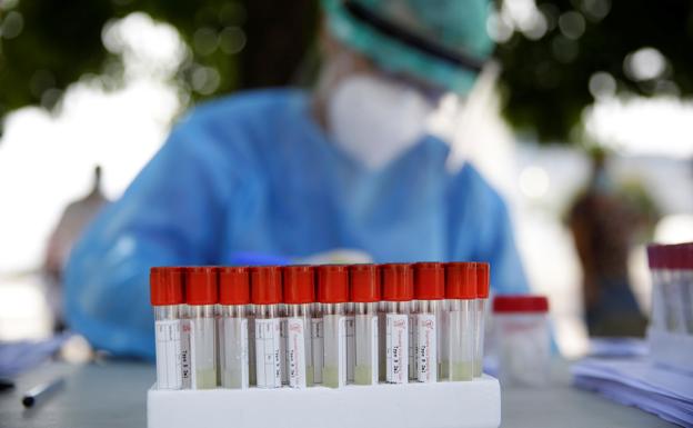 La pandemia sigue golpeando a Almería: dos fallecidos más y 160 casos nuevos