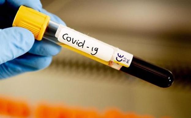 Con once muertes, Jaén es la provincia de Andalucía que más fallecidos de Covid registra en la última jornada