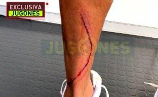 'Jugones' muestra el corte de Marvin tras la entrada de Machís