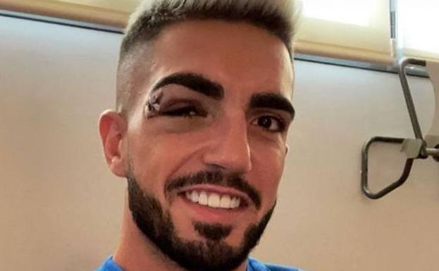 Monchu Rodríguez podrá jugar en Vallecas si la inflamación se rebaja