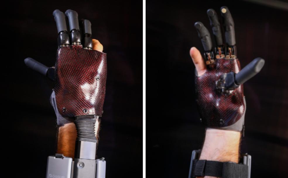 Una mano biónica tan única como su propia mano