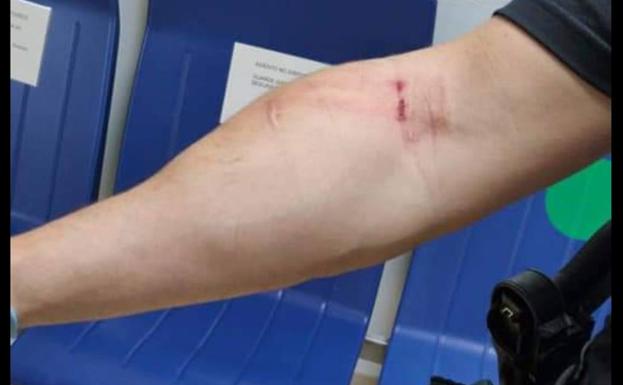 Suspendido el juicio a un vecino de Pinos por romper el brazo a un agente con un bate