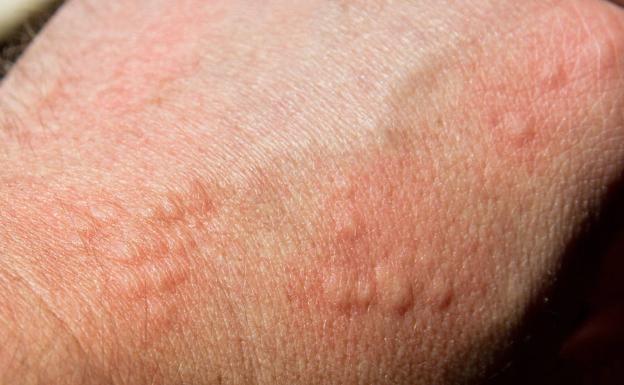 ¿Qué es la histamina, famosa ahora por el atún contaminado, y cómo puedes intoxicarte?