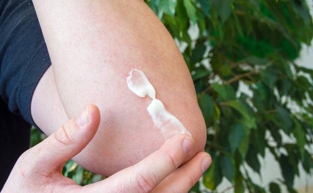 Más de 100.000 almerienses tienen dermatitis atópica, una afección con derivadas psicológicas