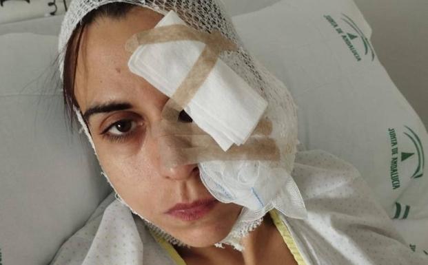 La mujer atacada por dos perros peligrosos en Armilla recibe el alta y presenta la denuncia