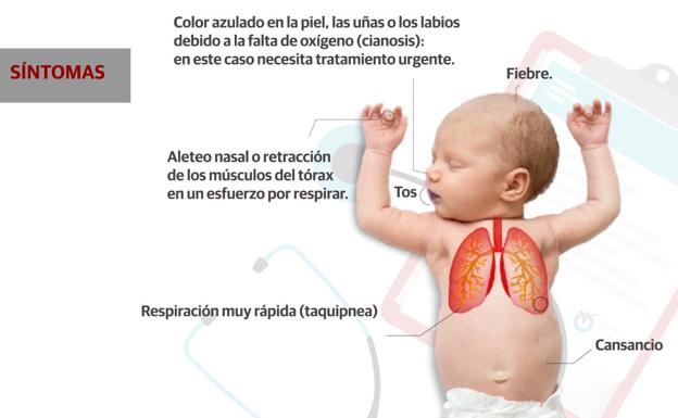 ¿Cuándo llevar a tu hijo al hospital por bronquiolitis? Ojo a las pausas respiratorias