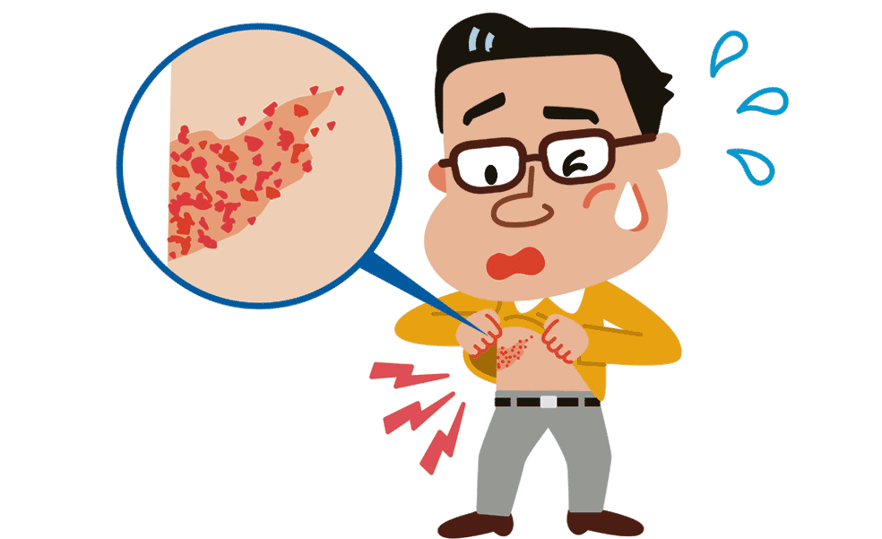El herpes zóster, la amenaza dolorosa | El Correo