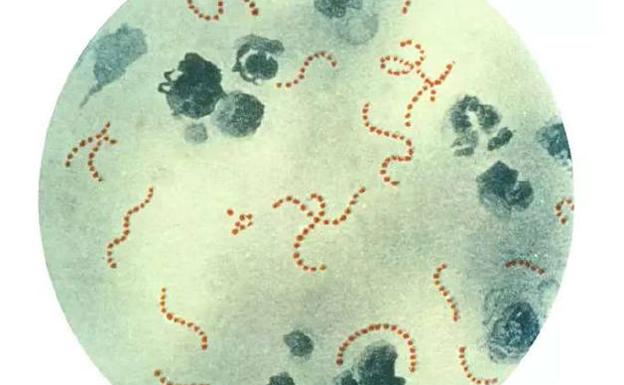 Descubren un anticuerpo que podría permitir nuevas terapias contra el estreptococo del grupo A