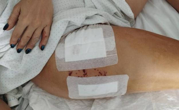 La jueza reabre la causa sobre el perro reincidente que atacó a una niña y su madre en Armilla