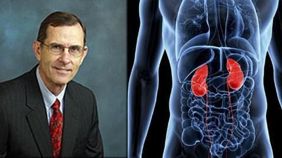 Extirpó el riñón equivocado a un paciente confiando en su memoria porque no conocía su historia clínica