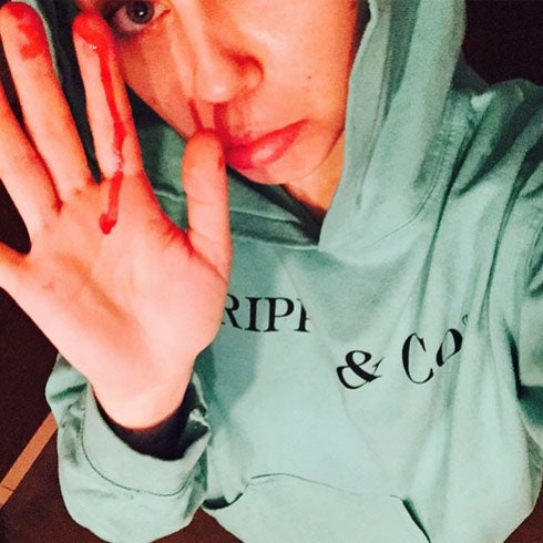 Miley Cyrus: polémica en Instagram, su foto sangrando por la nariz
