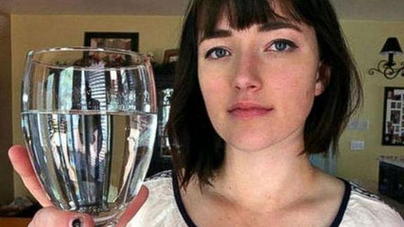 La chica que tiene una extraña alergia al agua