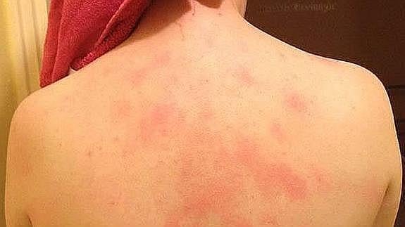 La mujer que es alérgica a los besos de su marido