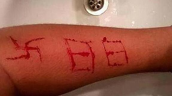 Neonazis agreden a un menor y le graban una esvástica en el brazo con una navaja