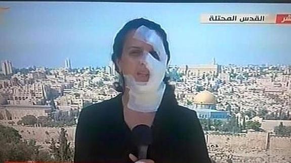 Continúa con la crónica tras ser herida por una granada