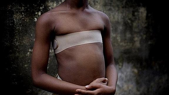 El 'planchado de pecho', una práctica que crece en Europa de forma preocupante