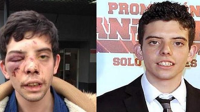 Propinan Una Brutal Paliza A Un Actor De Cuentame Ideal