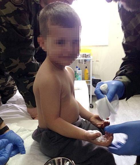 Sanitarios españoles auxilian en el Líbano a un niño con quemaduras