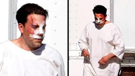 ¿Qué le ha pasado a Ben Affleck en la cara?