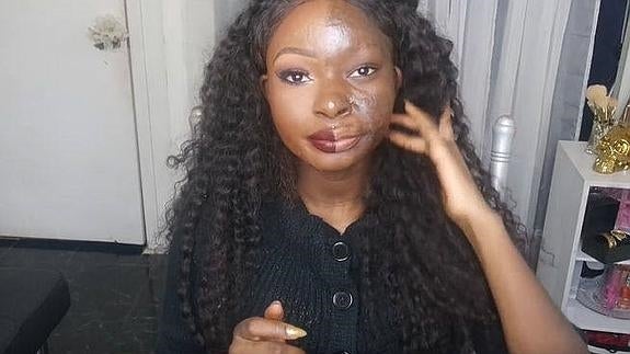 Conquista las redes con tutoriales sobre maquillaje tras sufrir graves quemaduras