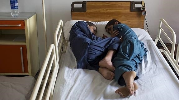 El extraño caso de los «niños solares» que desconcierta a los médicos de Pakistán