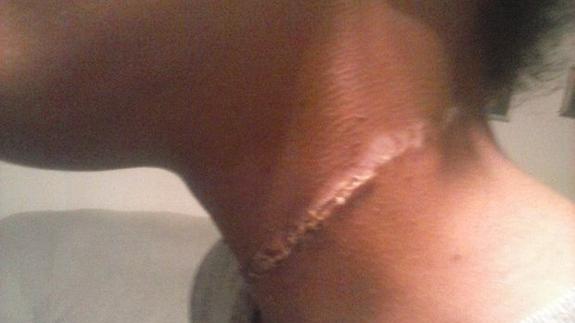 Un grupo de niños agreden a una compañera negra atándole una cuerda en el cuello