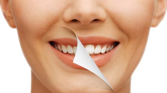 De para Kit dientes brillantes