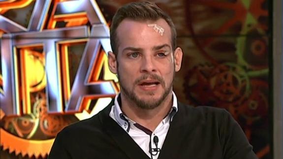 Álex Casademunt: "Vivo de mi cara y estuve a punto de perder el ojo"